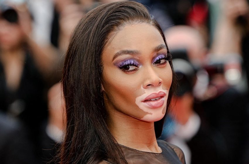  «Francamente e indecentemente»: la top model Winnie Harlow è venuta al matrimonio di un’amica con un abito che non copriva nulla