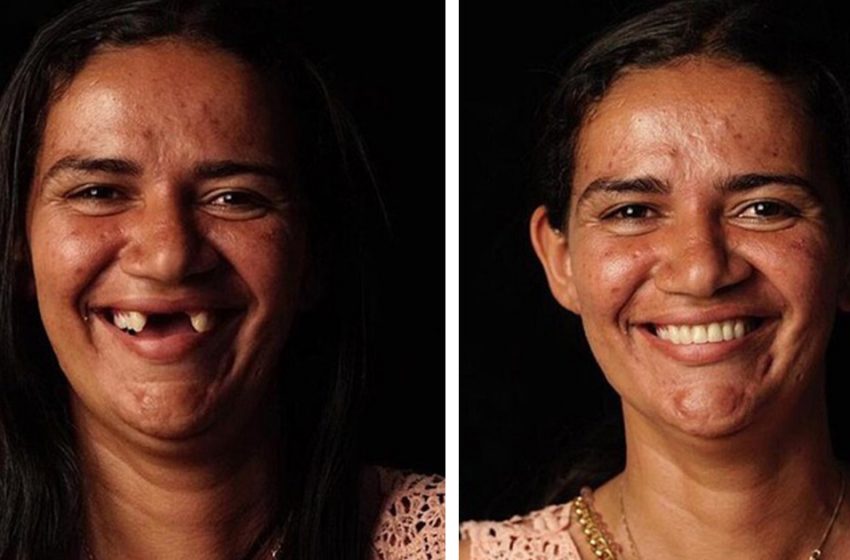  Il dentista brasiliano trasforma 12 persone regalando loro un bel sorriso