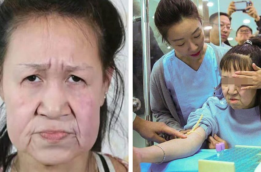  Com’è andata la vita di Xiao Feng, una donna cinese che a 15 anni aveva le sembianze di una vecchia